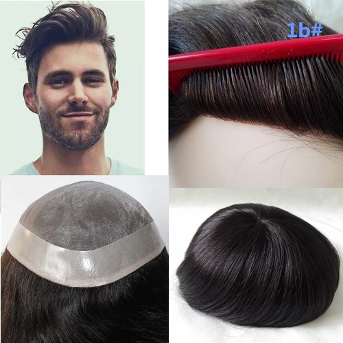 Hair Patch and Hair Wig in Delhi Hair Patch and Hair Wig in Delhi