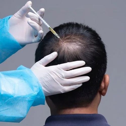 Hair Treatment Hair Treatment