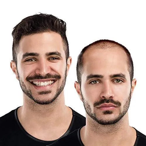 Non Surgical Hair Transplant in Delhi Non Surgical Hair Transplant in Delhi